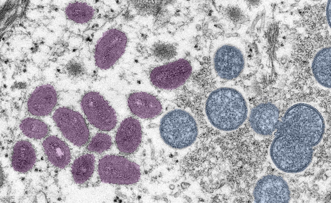International partners establish a global mpox vaccine stockpile